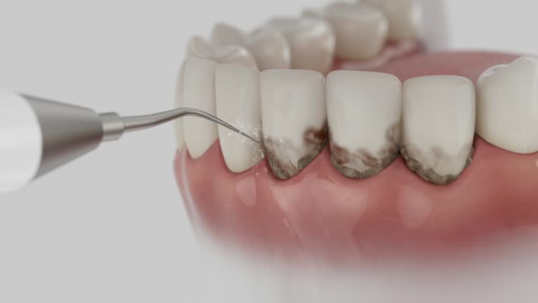 Trusted Emergency Dentist service in Hazard, KY - Dentist Open Now